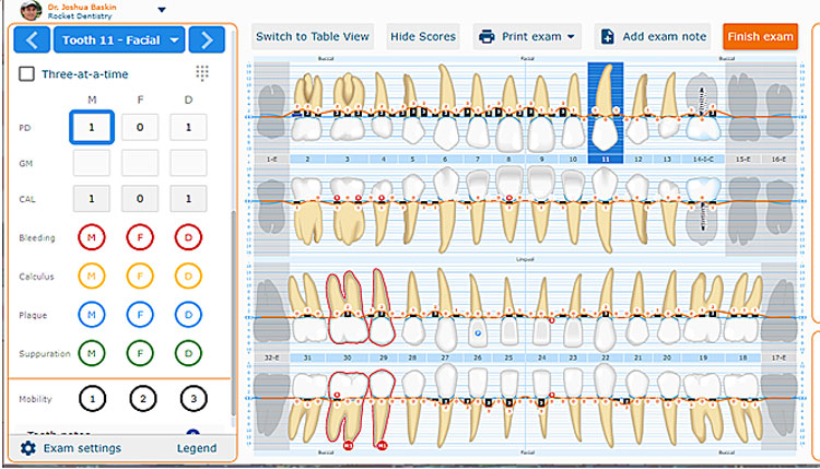 Example of a digital perio chart