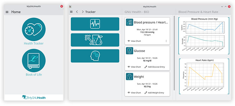 Tracking Patient's Physiological Parameters with GNUHealth